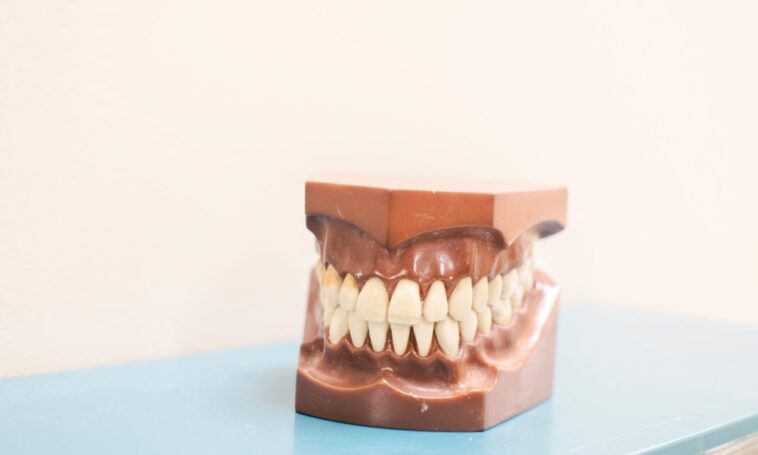 Les risques potentiels liés aux facettes - Trotons Tech Magazine